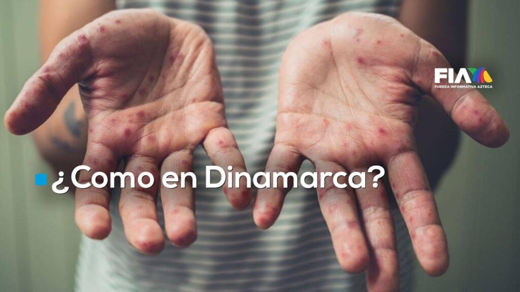 Crisis por sarampión en México: No hay vacunas y suspenden servicio por día de asueto