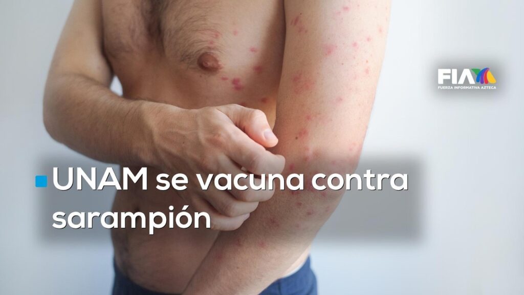 UNAM inicia jornada de vacunación contra sarampión en preparatorias y CCH