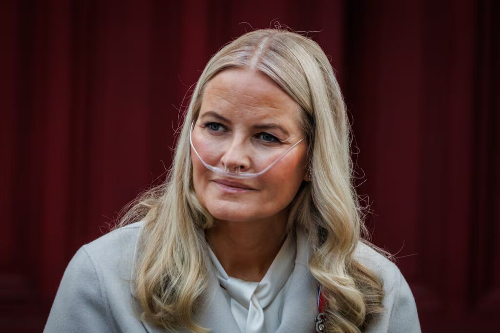 Mette-Marit de Noruega, sometida a un trasplante de pulmón con éxito | Gente